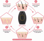 IPL Laser për Heqje Qimesh - Image 6